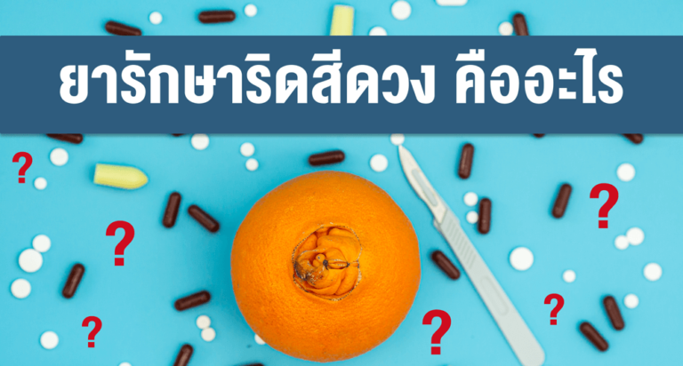 14 ข้อควรรู้โรคริดสีดวงทวาร คืออะไร? มีสาเหตุและอาการอย่างไรบ้าง?