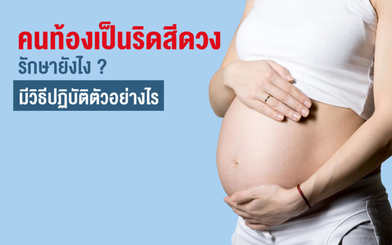 คนท้องเป็นริดสีดวง อันตรายไหม? รักษายังไง? มีวิธีปฏิบัติตัวอย่างไร