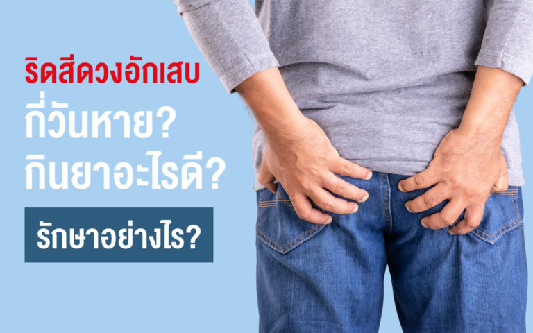 ริดสีดวงอักเสบ กี่วันหาย? กินยาอะไรดี? รักษาอย่างไร?