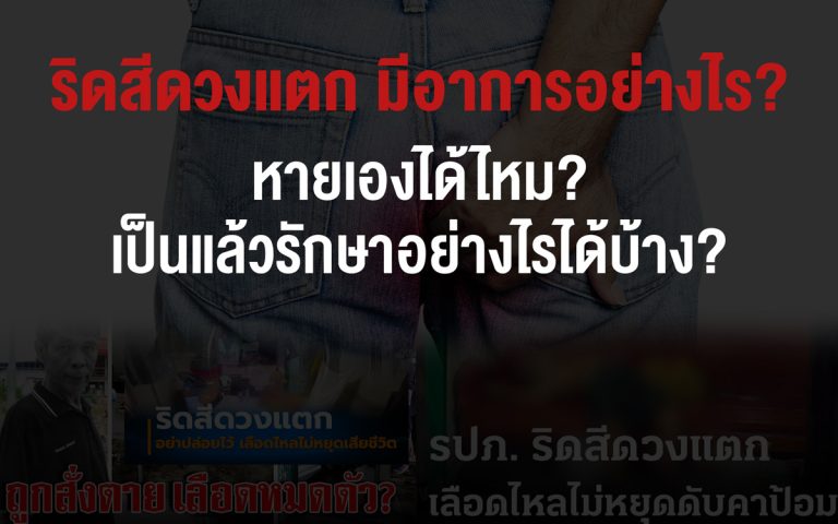 ริดสีดวงแตก มีอาการอย่างไร? หายเองได้ไหม? เป็นแล้วรักษาอย่างไรได้บ้าง?